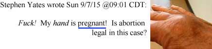 Stephen Yates wrote Sun 6/7/15 @09:01 CDT: Fuck! My hand is pregnant! Is abortion legal in this case?