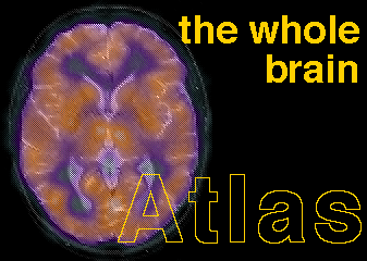 The whole brain