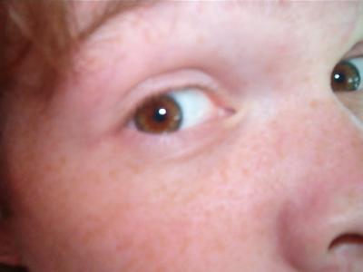 Zak's Eyes