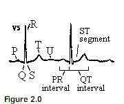 ecg.gif (1048 bytes)