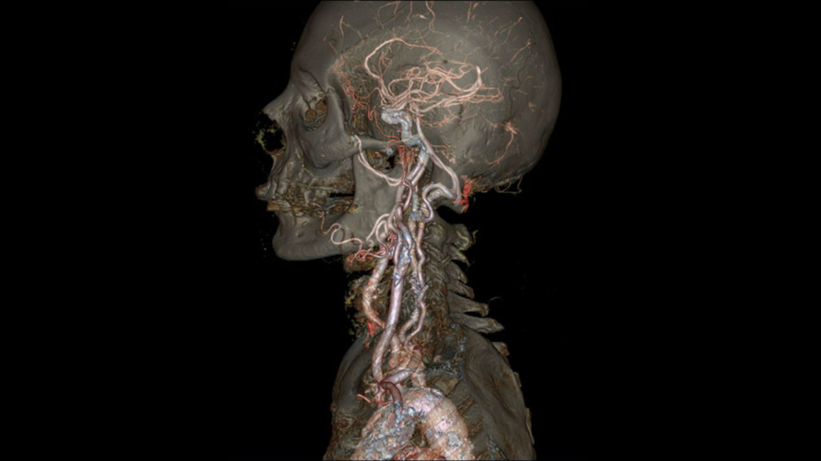  Ge CT scanner 2013 