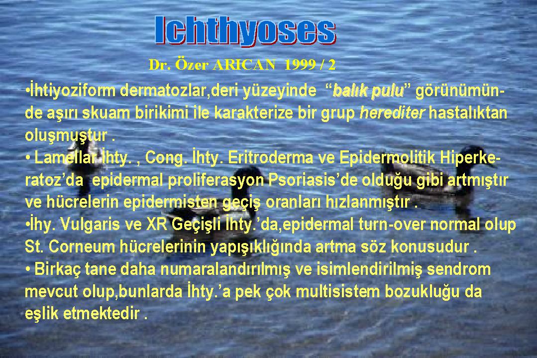 Ichthyosis02