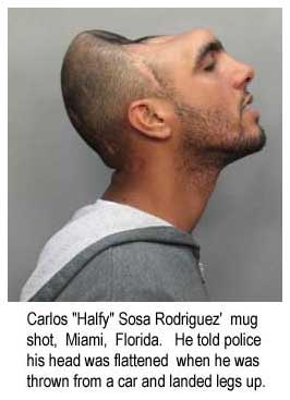 Carlos "Halfy" Sosa Rodriguez' mug shot, Miami, Florida, he told police his head was flattened when he was thrown from a car and landed legs up