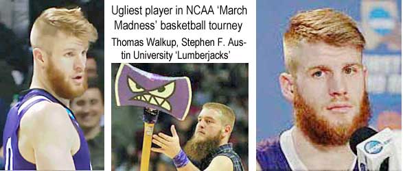 Ugliest player in NCAA 'March Madness' basketball tourney, Thomas Walkup, Stephen F. Austin University 'Lumberjacks"