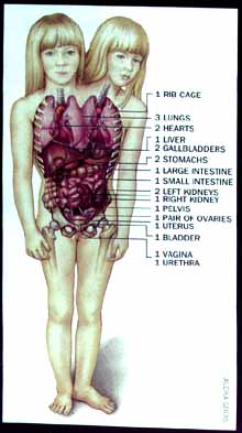 Diagram of Organs