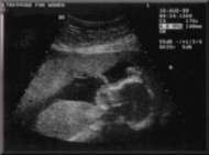 Sarah's ultrasound on August 16, 1999